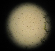 サンパチェンスの気孔細胞を顕微鏡で拡大している写真