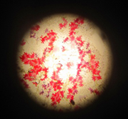 サンパチェンスの色素細胞を顕微鏡で拡大している写真